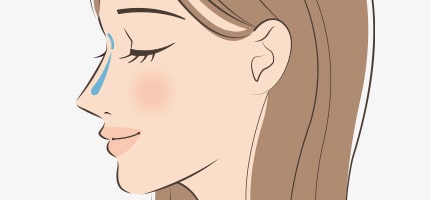鼻のヒアルロン酸注射イメージ