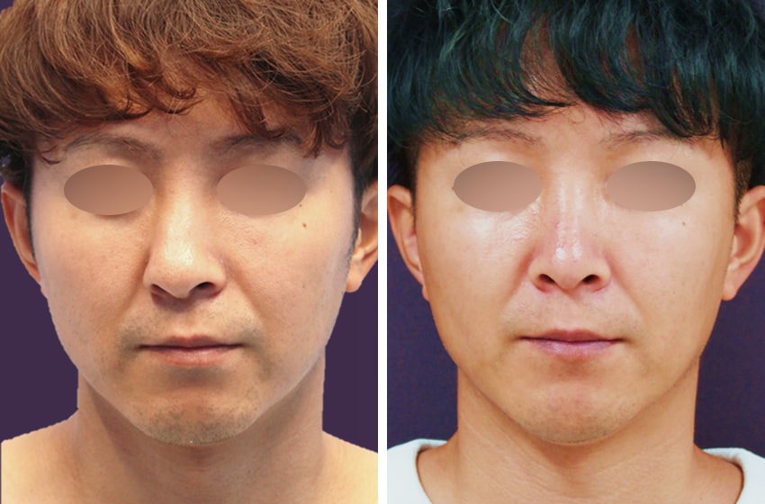 男性の美容整形外科 メンズtaクリニック 名医がモテる男を総合プロデュース イケメン 鼻 二重 美肌 ダイエット 二重整形