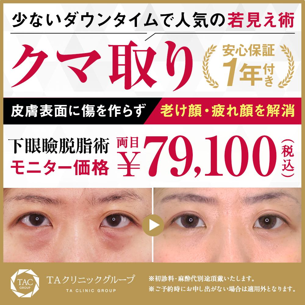下眼瞼脱脂（目の下のクマ・ふくらみとり）モニター募集