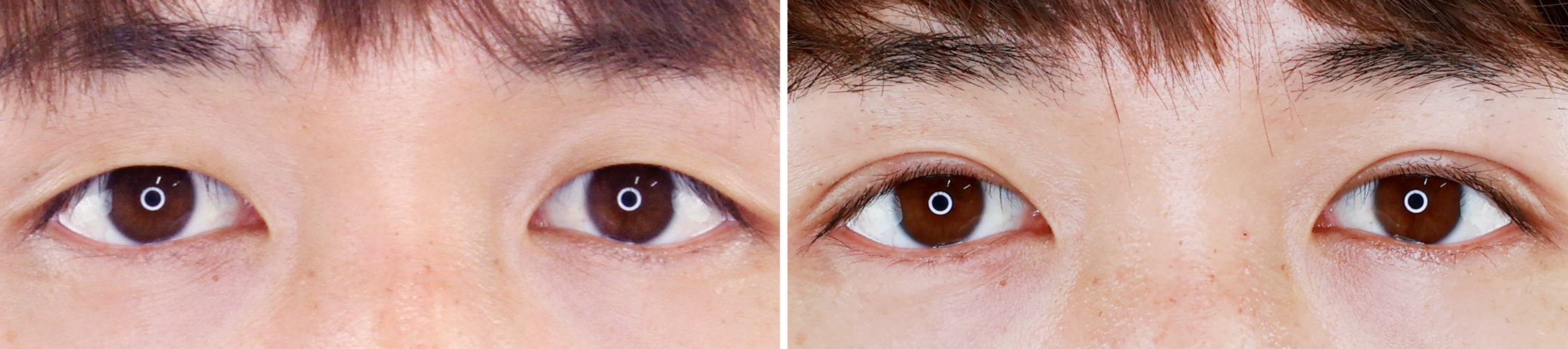 男性の美容整形外科 メンズtaクリニック 名医がモテる男を総合プロデュース イケメン 鼻 二重 美肌 ダイエット 二重整形