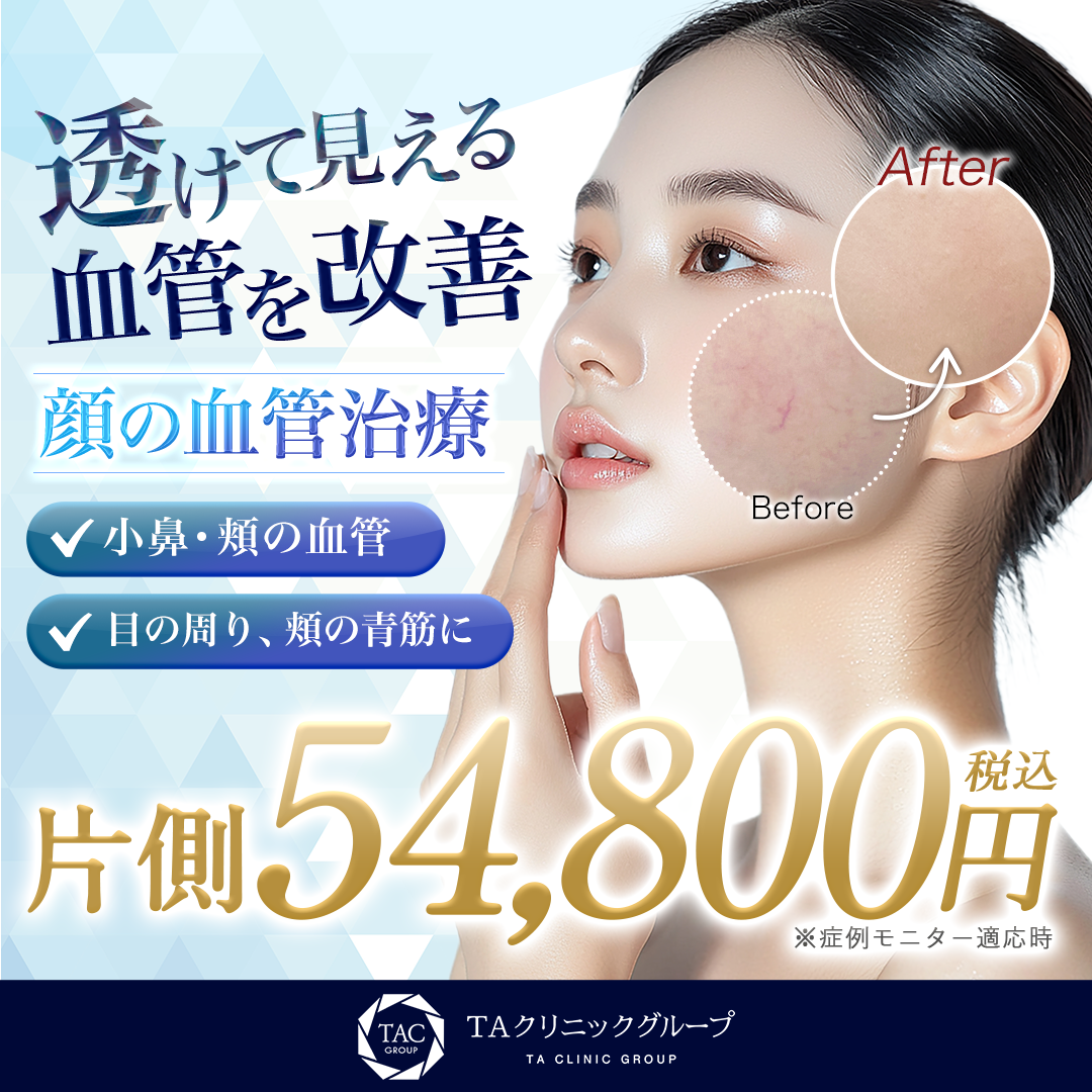 顔の血管治療_モニター募集