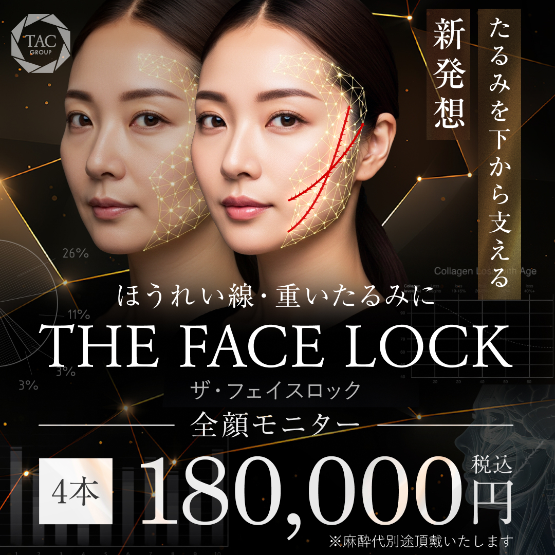 ザ・フェイスロック