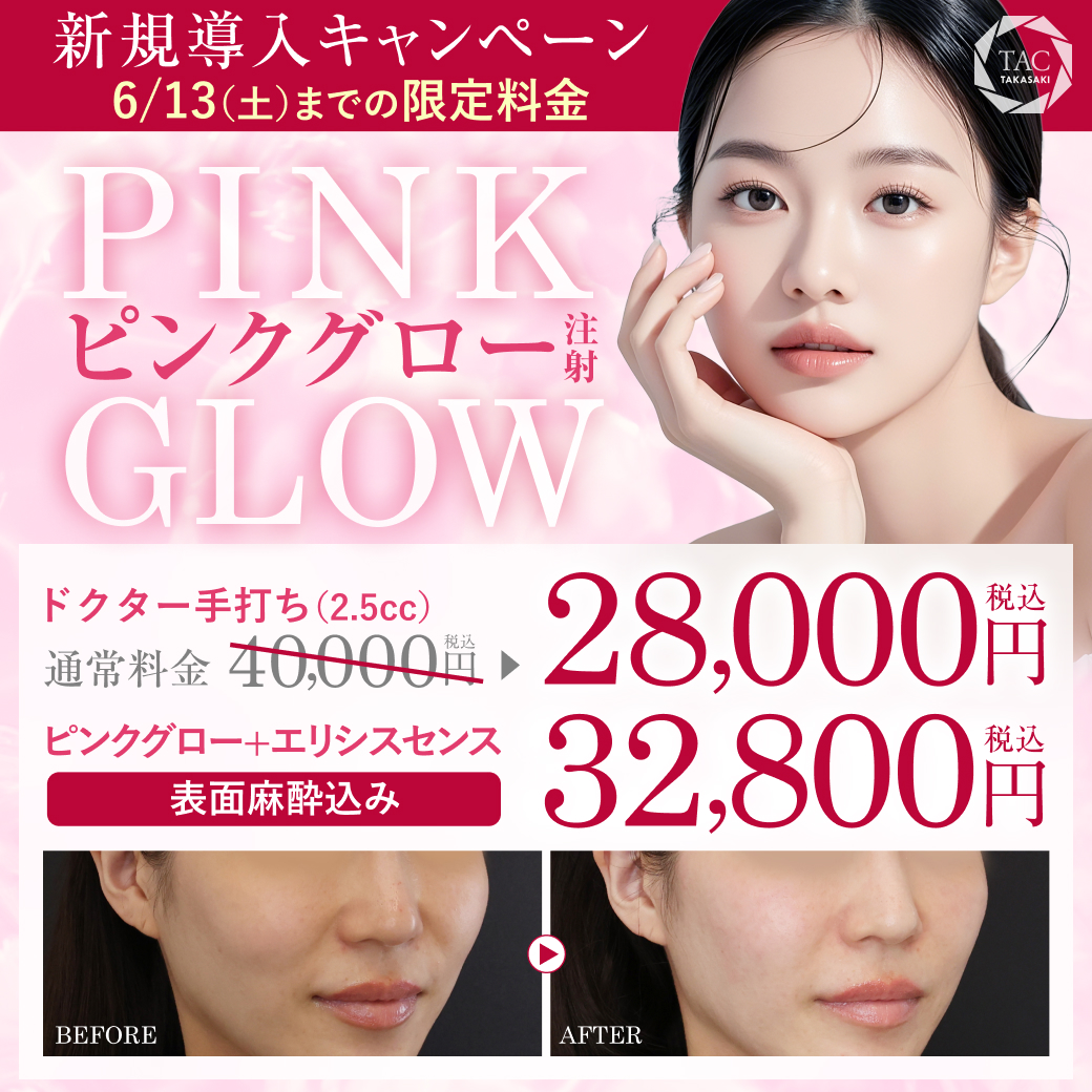 ピンクグロー_キャンペーン価格